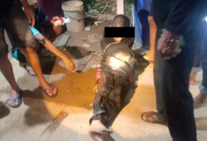 Sadis! Anak 13 Tahun Dianiaya Berat di Ketapang, Polisi Dalami Kasusnya